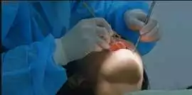 Emergency Dentist St Louis, St Louis