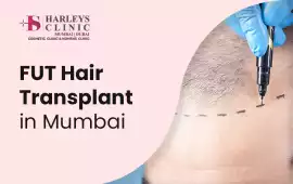 Get Natural Results with FUT Hair Transplant in Mu, Mumbai