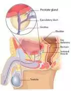 Best Prostate Cancer Surgery & Treatment , Ahmedabad