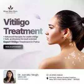 Vitiligo Specialist Doctor in Patna, Patna