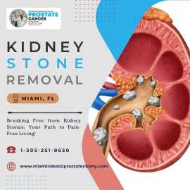 Kidney Stone Removal in Miami, Miami