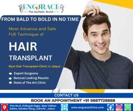Hair Transplant at Engrace Clinics Jaipur, Jaipur