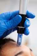 PRP Treatment in Abu Dhabi, Abu Dhabi
