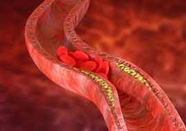 Best TAVR Doctor in Jaipur - Consult Now!, Jaipur