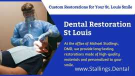 Your Trusted Source for Dental Restoration, St Louis