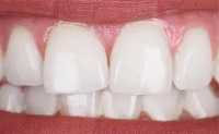 Achieve Optimal Oral Health: Visit South Harrow's , London