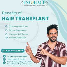 Hair Transplant in Jaipur , Jaipur