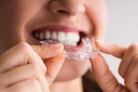 Root Canal in Woodbridge, VA: Effective Relief, Woodbridge
