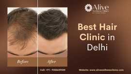 Best hair clinic in Delhi - Alive Wellness Clinic, Delhi