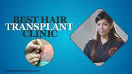 Best Hair Transplant Clinic In Delhi, New Delhi