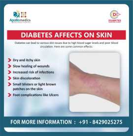 Dr. Mayank Somani for Diabetes Affects on Skin, Lucknow