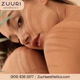 Alastin ha Immerse Serum | ZUURI Aesthetics, Rancho Cucamonga