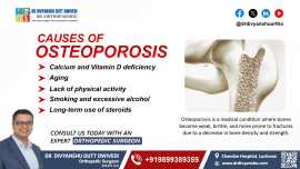 Cause of Osteoporosis | Dr. Divyanshu Dutt Dwivedi, Lucknow