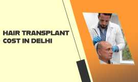 Hair Transplant Cost In India | DMC Trichology, New Delhi