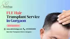 FUE Hair Transplant Service in Gurgaon, Gurgaon