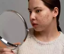 Advanced Pigmentation Treatment in Dubai for Clear, Dubai