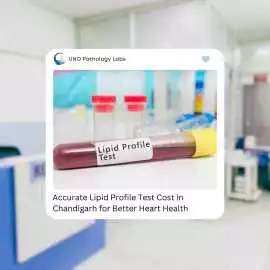 Accurate Lipid Profile Test Cost in Chandigarh , Chandigarh