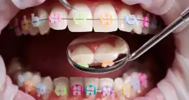 Affordable Orthodontic Treatment In Siliguri For A, Siliguri
