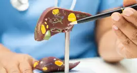 Experienced Liver Specialist in Siliguri for Bette, Siliguri