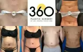 360 Plastic Surgery, Austin