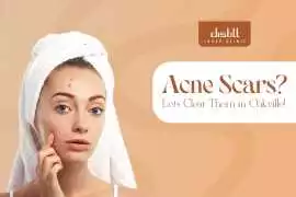 Botox Treatment For Youthful Skin In Oakville, Oakville