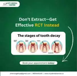 Best Root Canal Treatment in Noida, Noida