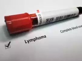 Lymphoma Canada Stands with You!, Mississauga
