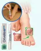 Why Is the Orivelle Fungus Pen Trending in the USA, New Hyde Park