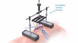 Abdomen Surgery in India with Olivine Internationa, Kolkata