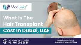 Hair Transplant Cost in Dubai, New Delhi