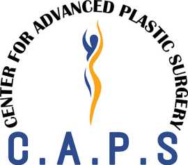 Facelift Surgery In Delhi, New Delhi