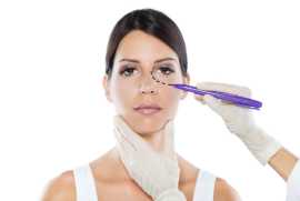 Transform Your Look with Custom Eyelid Surgery, Richmond
