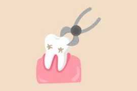 5 Reasons why extraction of wisdom tooth  , Novena