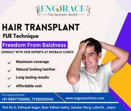 Hair Transplant in Jaipur, Jaipur
