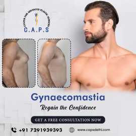Gynecomastia Surgery in Delhi, New Delhi