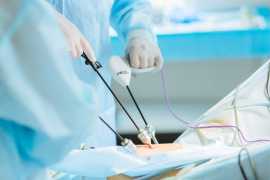 Laparoscopic Surgery in, Ahmedabad