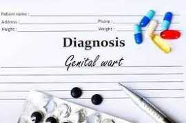 Should I be worried if I have genital warts and ot, Novena