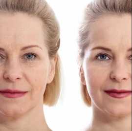 Opus Plasma Treatment in New Jersey, Iselin