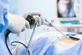 Hysterectomy Surgery in Gujarat, Ahmedabad