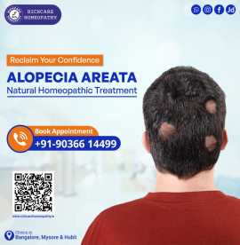 Hair fall Homeopathy Treatments in Bangalore -Rich, Bengaluru