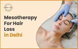 Mesotherapy For Hair Loss In Delhi, Delhi