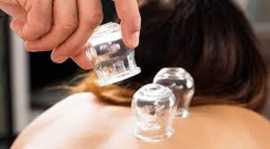 Cupping NYC, New York