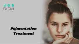 Pigmentation Treatment In Bangalore, Bengaluru
