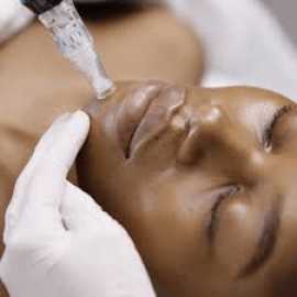 SkinPen Medical Microneedling at Vienna Aesthetic , Vienna