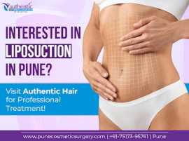 Searching For Top Liposuction Services in Pune?, Pune