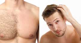 Body Hair Transplant In Delhi - DMC Trichology, New Delhi