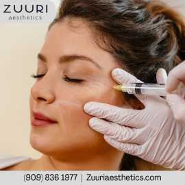 Botox Rancho Cucamonga CA | ZUURI Aesthetics, Rancho Cucamonga