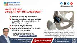 Bipolar Hip Replacement in Lucknow | Dr. Divyanshu, Lucknow