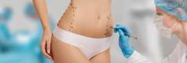 Peonia Medical | Expert Liposuction Services  , London