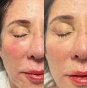 Top Medical Spa Orlando for Rejuvenating Treatment, Winter Park